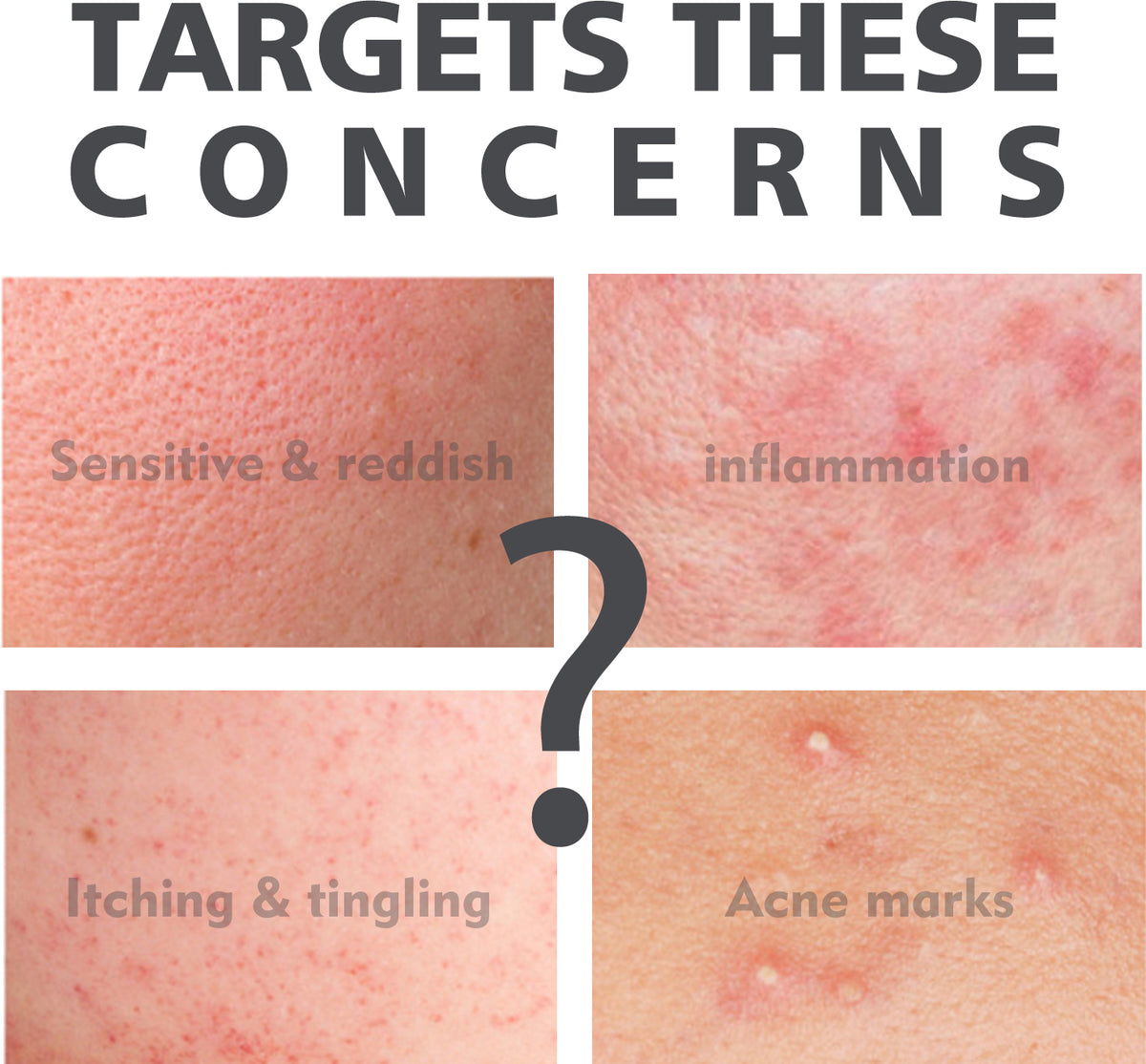 Sérum Acide Salicylique – Anti-Acné & Hydratant